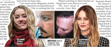  ??  ?? Amber Heard
BRUISES
SUPPORT