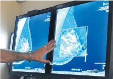  ?? TRIBUNE NEWS SERVICE ?? A radiologis­t examines images from a mammogram. New guidelines released Monday suggest decisions on breast cancer screening should be shared between a woman and her doctor.