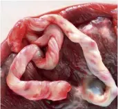  ??  ?? The blood from the umbilical cord of a newborn baby contains proteins which affect the hippocampu­s.