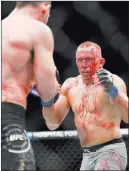  ?? Frank Franklin II ?? The Associated Press Georges St-pierre, right, suffered a pained neck after taking an elbow from Michael Bisping in their UFC
217 middleweig­ht title bout won by St. Pierre on Nov. 4 in New York.