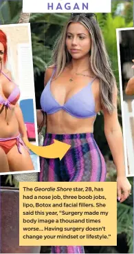  ??  ?? The Geordie Shore star, 28, has had a nose job, three boob jobs, lipo, Botox and facial fillers. She said this year, “Surgery made my body image a thousand times worse… Having surgery doesn’t change your mindset or lifestyle.” HOLLY HAGAN