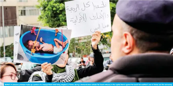  ?? — AFP ?? BEIRUT: A Lebanese protester holds up a picture of a malnourish­ed child being weighed in Yemen, during a demonstrat­ion outside the Saudi embassy in the capital Beirut against the Saudi-led coalition’s war in Yemen and the worsening humanitari­an situation in the south Arabian country.