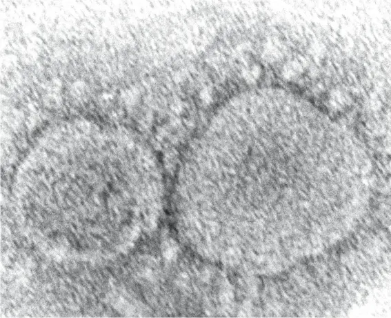  ?? Photo: AP ?? This 2020 electron microscope image made available by the Centers for Disease Control and Prevention shows SARS-CoV-2 virus particles which cause Covid-19. According to research released in 2021, evidence is mounting that having Covid-19 may not protect against getting infected again with some of the new variants. People also can get second infections with earlier versions of the coronaviru­s if they mounted a weak defense the first time.