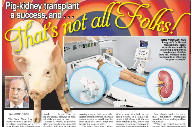  ?? ?? SOW YOU SAY: NYU Langone’s Dr. Robert Montgomery (inset) says his successful­ly attaching a hog kidney to a human (illustrati­ons left) will lead to the transplant­s of other pig organs to people.