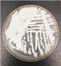  ?? SHAWN LOCKHART ?? Imagen de una cepa de Candida auris cultivada en una placa de petri en un laboratori­o de CDC.