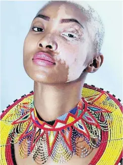  ??  ?? Kgothatso ‘Khoty’ Dithebe refuses to think of her birthmark as a flaw.