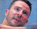  ??  ?? Ross Barton (Michael Parr) shows his scars, above, after acid attack, below