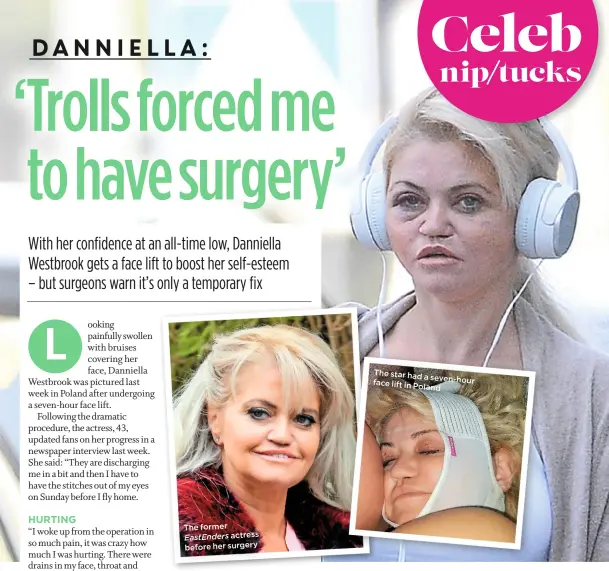  ??  ?? The former Eastenders actress before her surgery The star had a seven-hour face lift in Poland