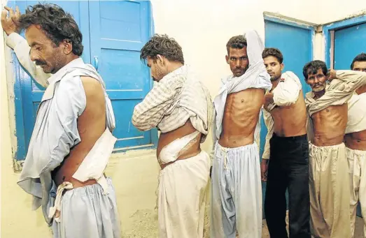  ?? Picture: AFP ?? DRIVEN BY POVERTY: Pakistani men at a police station reveal scars after their kidneys were removed by a gang who ran a clandestin­e clinic trading in human organs in Lahore