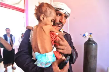  ??  ?? A Yemeni man carries his child who is suffering from malnutriti­on into a treatment centre at a hospital in the capital Sanaa. — AFP photo