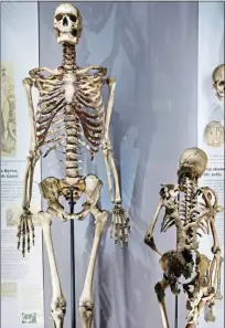  ??  ?? Macabre curiosity: Charles Byrne’s skeleton, above left, became a centrepiec­e of the Hunterian Museum’s exhibits. It has been used for modern research