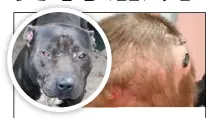  ??  ?? 台東一歲半男童，慘遭自家飼養的比特犬­攻擊，導致頭部嚴重撕裂傷。（圖：台東馬偕醫院提供）