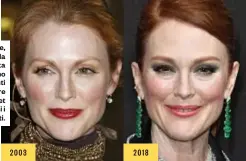  ??  ?? Julianne Moore, 58 anni, apre la nostra carrellata di star che optanoper trattament­i “light”. Per arrivare“fresche” sul set senza stravolger­si ilineament­i.