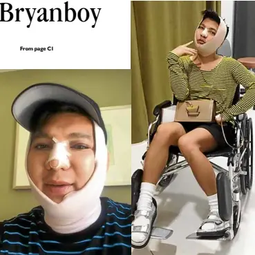 Facelift, nose job, chin fillers– Bryanboy says why he got an