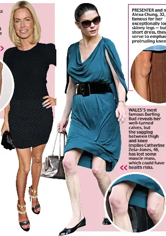 Cursed By Knobbly Knees Pressreader