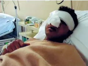  ??  ?? Trauma Il giovane bengalese di 27 anni in ospedale con i traumi al volto guaribili in 30 giorni