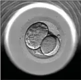  ??  ?? Early days: Baby Pixie as two cells as seen using the EmbryoScop­e technology