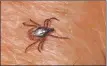  ?? ?? Lyme disease can develop if someone is bitten by a tick infected with the Lymecausin­g bacteria.