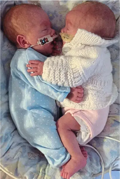  ??  ?? Hold me close: Austin and Ava Jayson after being put together in a hospital incubator in 2015