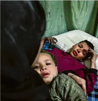  ?? Hamza al-Ajweh/AFP ?? Sírios buscam atendiment­o em clínica improvisad­a em Douma, na área de Ghouta Oriental