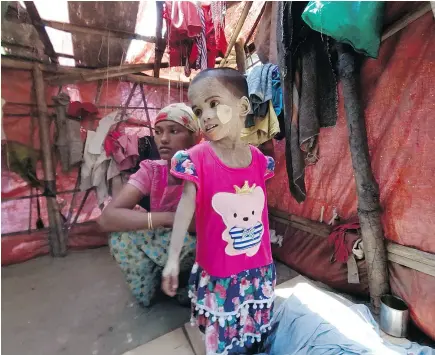  ?? TODD PITMAN / THE ASSOCIATED PRESS ?? Rosmaida Bibi, a four-year old Rohingya girl who suffers from severe malnutriti­on, stands next to her mother Hamida Begum inside a squalid tent at the Dar Paing camp in Myanmar.