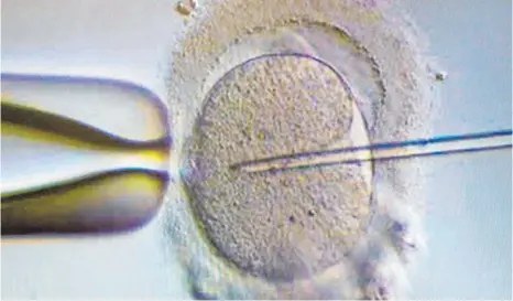  ?? FOTO: KLAUS-DIETMAR GABBERT ?? Ein Spermium wird einer Eizelle injiziert: Gespendete Eizellen, die sich nach dem Zusammenbr­ingen mit der Samenzelle noch im Vorkernsta­dium befinden, dürfen nach einem Urteil des Bayerische­n Obersten Landesgeri­chts nicht an eine andere Frau übertragen werden.
