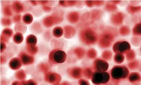  ??  ?? Research by the University of Essex’s Institute for Social and Economic Research is looking at blood biomarkers from nearly 8,000 adults. Photograph: Juras/Alamy