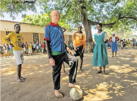  ?? BILD: SN/WFP/BADRE BAHAJI ?? Menschen mit Albinismus brauchen die Unterstütz­ung anderer. In Afrika ist ihr Leben bedroht.