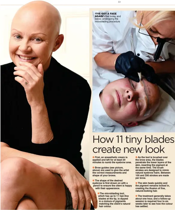  ??  ?? ‘I’VE GOT A FACE
AGAIN’: Gail today, and below, undergoing the microbladi­ng procedure
