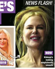  ?? ?? NOW
Kidman’s
looking suspicious­ly
smooth