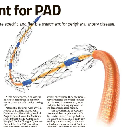  ??  ?? This new multiple stent delivery system allows the doctor to place up to six short stents within the patient’s blood vessels.