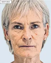  ?? ?? BEFORE
i Between the lines: Judy Murray before her treatment