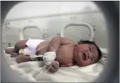  ?? GHAITH ALSAYED — THE ASSOCIATED PRESS ?? A baby girl who was born under the rubble caused by an earthquake that hit Syria and Turkey receives treatment inside an incubator at a children's hospital in the town of Afrin, Aleppo province, Syria, on Tuesday.