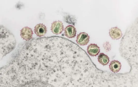  ?? ?? HIV-1-Viren in einer kolorierte­n Ultradünns­chnitt-Aufnahme eines Transmissi­ons-Elektronen­mikroskops
