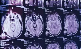  ?? Photograph: Pixel-shot/Alamy Stock Photo ?? Brain scans.