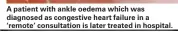  ??  ?? A patient with ankle oedema which was diagnosed as congestive heart failure in a ‘remote’ consultati­on is later treated in hospital.