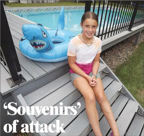  ?? (AP/The Citizens’ Voice/Dave Scherbenco) ?? Shark bite survivor Jordan Prushinski sits by the family pool Aug. 7 at her home in Plains Township, Pa.