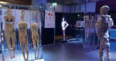  ??  ?? Per stomaci forti Qui sopra e a destra, alcuni dei corpi «in plastilina» che saranno in mostra a Bolzano