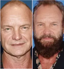  ??  ?? Should be arrested: Ex-Police star Sting joins the Fuzz