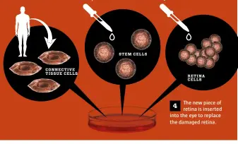  ??  ?? STEM CELLS CONNECTIVE TISSUE CELLS RETINA CELLS