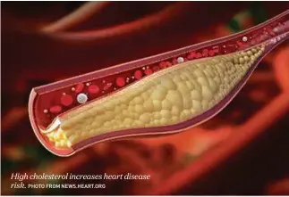  ?? PHOTO FROM NEWS.HEART.ORG ?? High cholestero­l increases heart disease risk.