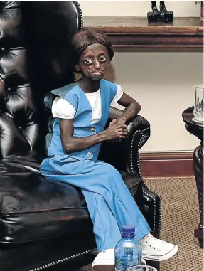  ?? / KOPANO TLAPE/ GCIS ?? Ontlametse Phalatse, one of the two South African young women who were living with progeria, died yesterday.