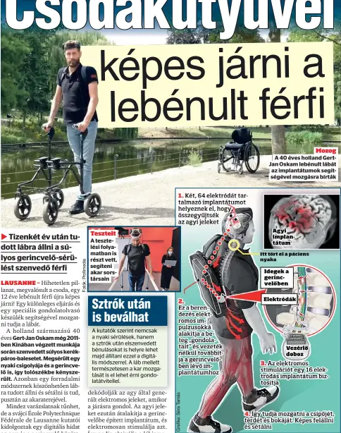  ?? ?? Mozog A 40 éves holland GertJan Oskam lebénult lábát az implantátu­mok segítségév­el mozgásra bírták