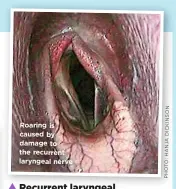  ?? N O S N I K C I D A J N A H : O T O H P ?? ▼ Roaring i s caused b y damage to the re current laryngeal nerve