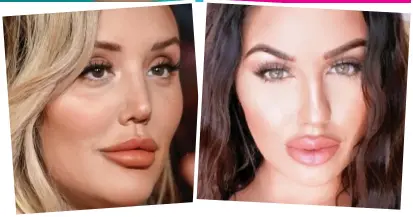  ??  ?? Recovering: Lydia Smith’s lips (top) were left swollen and lumpy after trying for the exaggerate­d pouts of reality TV stars such as Charlotte Crosby (above left) and Love Island’s Anna Vakili