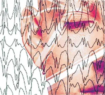  ?? FOTO: PR/ARCHIV ?? Wie bei epileptisc­hen Anfällen verändert sich laut neuen Erkenntnis­sen von US-Forschern auch vor dem Tod die Hirnaktivi­tät in bestimmten Frequenzbe­reichen.