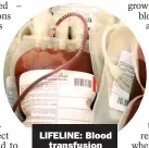  ??  ?? LIFELINE: Blood
transfusio­n