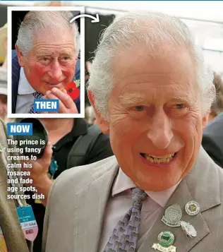 ?? ?? NOW
THEN
The prince is using fancy creams to calm his rosacea and fade age spots, sources dish