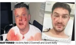  ??  ?? BATTERED
Victims Neil O’Donnell and Grant Kelly