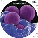  ??  ?? MRSA bacteria